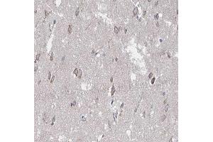 ABIN6266661 at 1/100 staining human brain tissue sections by IHC-P.