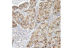 IHC analysis of ALDOA using anti-ALDOA antibody (ABIN7601907). (ALDOA antibody  (AA 50-364))