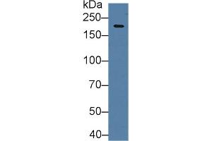 Western Blot; Sample:Mouse Cerebrum lysate; Primary Ab: 2µg/ml Rabbit Anti-Human HIF2a Antibody Second Ab: 0. (EPAS1 antibody  (AA 339-541))