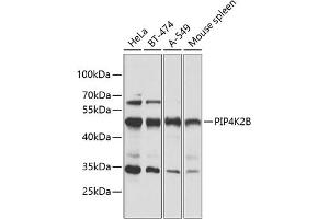 Western blot analysis of extracts of various cell lines, using PIP4K2B antibody (ABIN6130646, ABIN6145675, ABIN6145677 and ABIN6216199) at 1:1000 dilution. (PIP4K2B antibody  (AA 1-270))