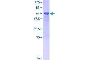Image no. 1 for TAR DNA Binding Protein (TARDBP) (AA 1-260) protein (GST tag) (ABIN3013392)