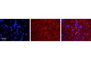 LBP antibody - C-terminal region          Formalin Fixed Paraffin Embedded Tissue:  Human Liver Tissue    Observed Staining:  Cell membrane in endothelial cell in sinusoids   Primary Antibody Concentration:  1:100    Other Working Concentrations:  1/600    Secondary Antibody:  Donkey anti-Rabbit-Cy3    Secondary Antibody Concentration:  1:200    Magnification:  20X    Exposure Time:  0. (LBP antibody  (C-Term))