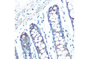 Immunohistochemistry of paraffin-embedded human colon using SFRP4 Rabbit mAb (ABIN7270180) at dilution of 1:100 (40x lens). (SFRP4 antibody)