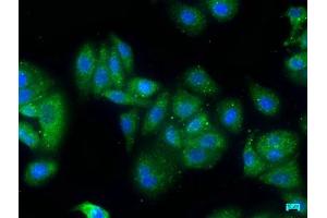 Immunofluorescence staining of HepG2 cells with ABIN7176068 at 1:50, counter-stained with DAPI. (ZFYVE9 antibody  (AA 683-926))