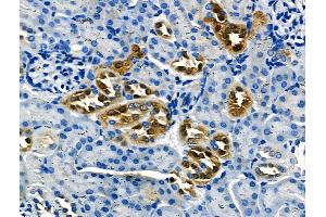 ABIN6264652 and ABIN6266628 at 1/100 staining Mouse kidney tissue by IHC-P. (RASH/RASK/RASN (N-Term) antibody)
