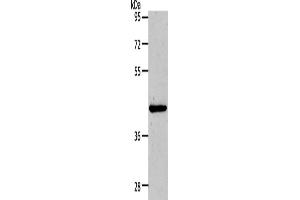 Western Blotting (WB) image for anti-Matrix Metallopeptidase 13 (Collagenase 3) (MMP13) antibody (ABIN2421022) (MMP13 antibody)