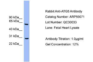 WB Suggested Anti-ATG5  Antibody Titration: 0. (ATG5 antibody  (Middle Region))