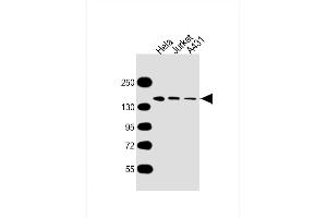 All lanes : Anti-MYBBP1A Antibody at 1:5000 dilution Lane 1: Hela whole cell lysate Lane 2: Jurkat whole cell lysate Lane 3: A431 whole cell lysate Lysates/proteins at 20 μg per lane. (MYBBP1A antibody  (AA 1104-1328))