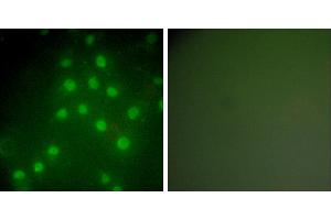 Peptide - +Immunofluorescence analysis of HepG2 cells, using HDAC9 antibody (#C0228).