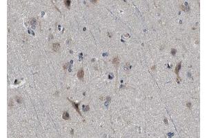 ABIN6272994 at 1/100 staining human brain tissue sections by IHC-P. (CPT1C antibody)