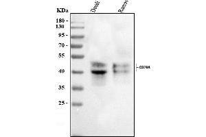 Western blot analysis of CD79A using anti-CD79A antibody (ABIN3043921).
