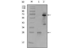 Western blot analysis using SYK mouse mAb against truncated SYK-His recombinant protein (1) and PMA induced THP-1 cell lysate (2). (SYK antibody  (AA 296-484))