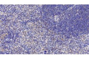 Detection of LY96 in Mouse Spleen Tissue using Polyclonal Antibody to Lymphocyte Antigen 96 (LY96) (LY96 antibody  (AA 16-160))
