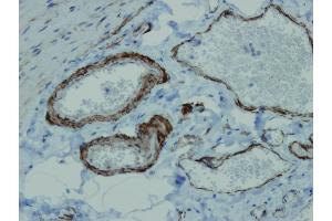 Immunohistochemistry (IHC) image for anti-Actin, alpha 2, Smooth Muscle, Aorta (ACTA2) (AA 3-16), (N-Term) antibody (ABIN7598769)