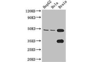 Western Blot Positive WB detected in: HepG2 whole cell lysate, Hela whole cell lysate, Mouse brain tissue All lanes: DNAAF4 antibody at 3. (Dynein Assembly Factor 4, Axonemal (DNAAF4) (AA 109-295) antibody)