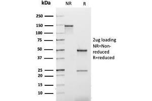 SDS-PAGE Analysis Purified Kappa Light Chain Mouse Recombinant Monoclonal Ab (rL1C1). (Recombinant IGKC antibody)
