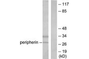 Western blot analysis of extracts from 293 cells, using PGP9. (UCHL1 antibody  (AA 171-220))
