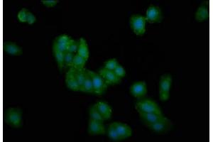 Immunofluorescence staining of HepG2 cells with ABIN7149966 at 1:100, counter-stained with DAPI. (DMGDH antibody  (AA 429-524))