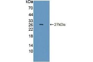 Detection of Recombinant INSM1, Mouse using Polyclonal Antibody to Insulinoma Associated Protein 1 (INSM1) (INSM1 antibody  (AA 278-518))