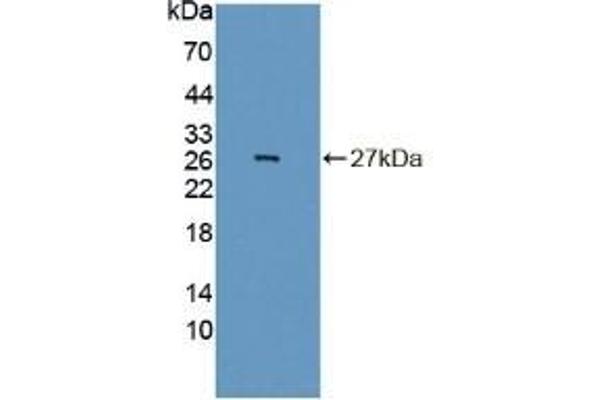 INSM1 Antikörper  (AA 278-518)