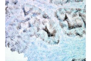 Immunohistochemistry analysis using Mouse Anti-Hsp60 Monoclonal Antibody, Clone LK-2 (ABIN361786 and ABIN361787). (HSPD1 antibody)