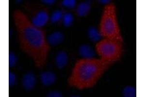 Immunofluorescence (IF) analysis of 293T cells transfected with a VSV-G-tagged protein,1:2000 dilution (blue DAPI, red anti-VSV-G) (VSV-g Tag antibody)