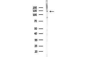 Western blot analysis of lysates from Mouse brain, using MAP4K4 Antibody at 1/1000 dilution.