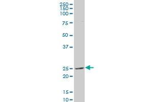 TSN polyclonal antibody (A01), Lot # NIH49060222QCS1 Western Blot analysis of TSN expression in PC-12 (Translin antibody  (AA 115-197))