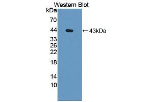 Western blot analysis of recombinant Rat CCK.