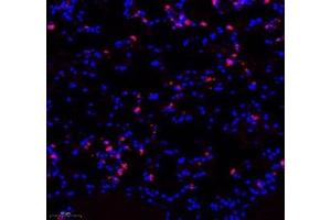 Immunofluorescence of paraffin embedded mouse lung using LTF (ABIN7074457) at dilution of 1: 700 (250x lens) (Lactoferrin antibody)