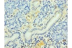Immunohistochemistry of paraffin-embedded human pancreatic tissue using ABIN7163625 at dilution of 1:100 (PDGFD antibody  (AA 191-370))