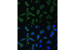 Immunofluorescence analysis of L-929 cells using EIF3D antibody (ABIN6130833, ABIN6140057, ABIN6140058 and ABIN6221638) at dilution of 1:100. (EIF3D antibody  (AA 1-240))