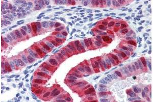 Uterus, Human: Formalin-Fixed, Paraffin-Embedded (FFPE) (Metallothionein antibody)