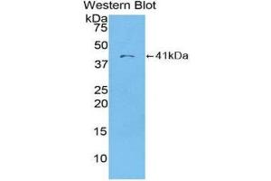 Western Blotting (WB) image for anti-Chemokine (C-C Motif) Ligand 22 (CCL22) (AA 25-93) antibody (ABIN1859795) (CCL22 antibody  (AA 25-93))