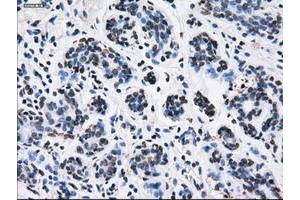 Image no. 3 for anti-Replication Protein A2, 32kDa (RPA2) antibody (ABIN1500736)