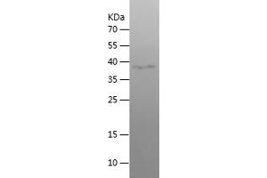 WFS1 Protein (AA 148-311) (His-IF2DI Tag)