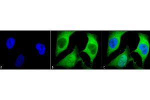 Immunocytochemistry/Immunofluorescence analysis using Mouse Anti-Ubiquitin Monoclonal Antibody, Clone 5B9-B3 (ABIN361810 and ABIN361811). (Ubiquitin antibody)