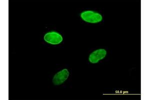 Immunofluorescence of purified MaxPab antibody to LBR on HeLa cell. (Lamin B Receptor antibody  (AA 1-615))