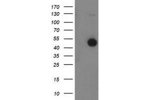 HEK293T cells were transfected with the pCMV6-ENTRY control (Left lane) or pCMV6-ENTRY BECN1 (Right lane) cDNA for 48 hrs and lysed. (Beclin 1 antibody)