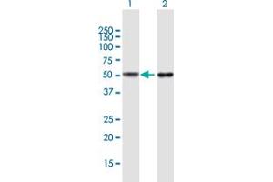 Western Blot analysis of TUBB4Q expression in transfected 293T cell line by TUBB4Q MaxPab polyclonal antibody. (TUBB7P antibody  (AA 1-434))