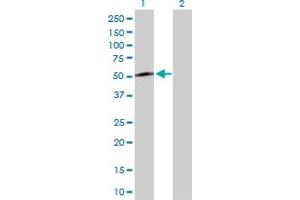 Western Blot analysis of KLF8 expression in transfected 293T cell line by KLF8 MaxPab polyclonal antibody. (KLF8 antibody  (AA 1-359))