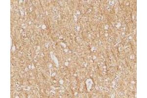 Immunohistochemical staining of human brain tissue using AP30096PU-N ATR antibody at 2 μg/ml. (ANTXR1 antibody  (Intermediate Domain))