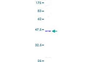 ADCK5 Protein (AA 1-169) (GST tag)