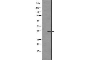 Western blot analysis of OR4C45 expression in HT1080 Whole Cell lysates ;,The lane on the left is treated with the antigen-specific peptide. (OR4C45 antibody)