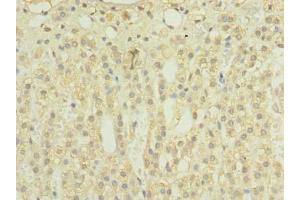 Immunohistochemistry of paraffin-embedded human adrenal gland tissue using ABIN7159908 at dilution of 1:100 (TIMM8B antibody  (AA 33-83))