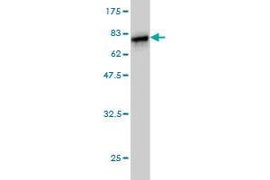 Western Blot detection against Immunogen (69. (HORMAD1 antibody  (AA 1-394))