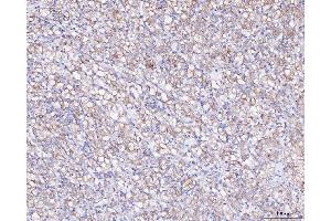 IHC analysis of ATX2/ATXN2 using anti-ATX2/ATXN2 antibody (ABIN3043507). (Ataxin 2 antibody  (C-Term))