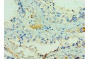 Immunohistochemistry of paraffin-embedded human testis tissue using ABIN7143270 at dilution of 1:100