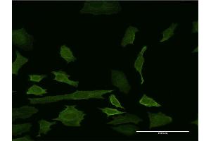 Immunofluorescence of monoclonal antibody to IDO1 on HeLa cell. (IDO1 antibody  (AA 304-403))
