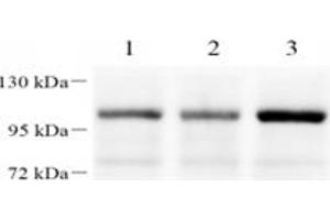 Western blot analysis of FOXK1 (ABIN7073970) at dilution of 1: 1000,Lane 1: HeLa cell lysate,Lane 2: 293T cell lysate,Lane 3: H1299 cell lysate (Foxk1 antibody)